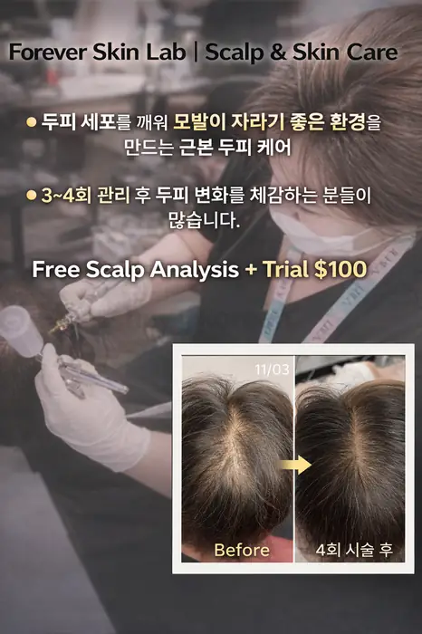 두피진단 + 탈모 상담 FREE in Bergen County, NJ